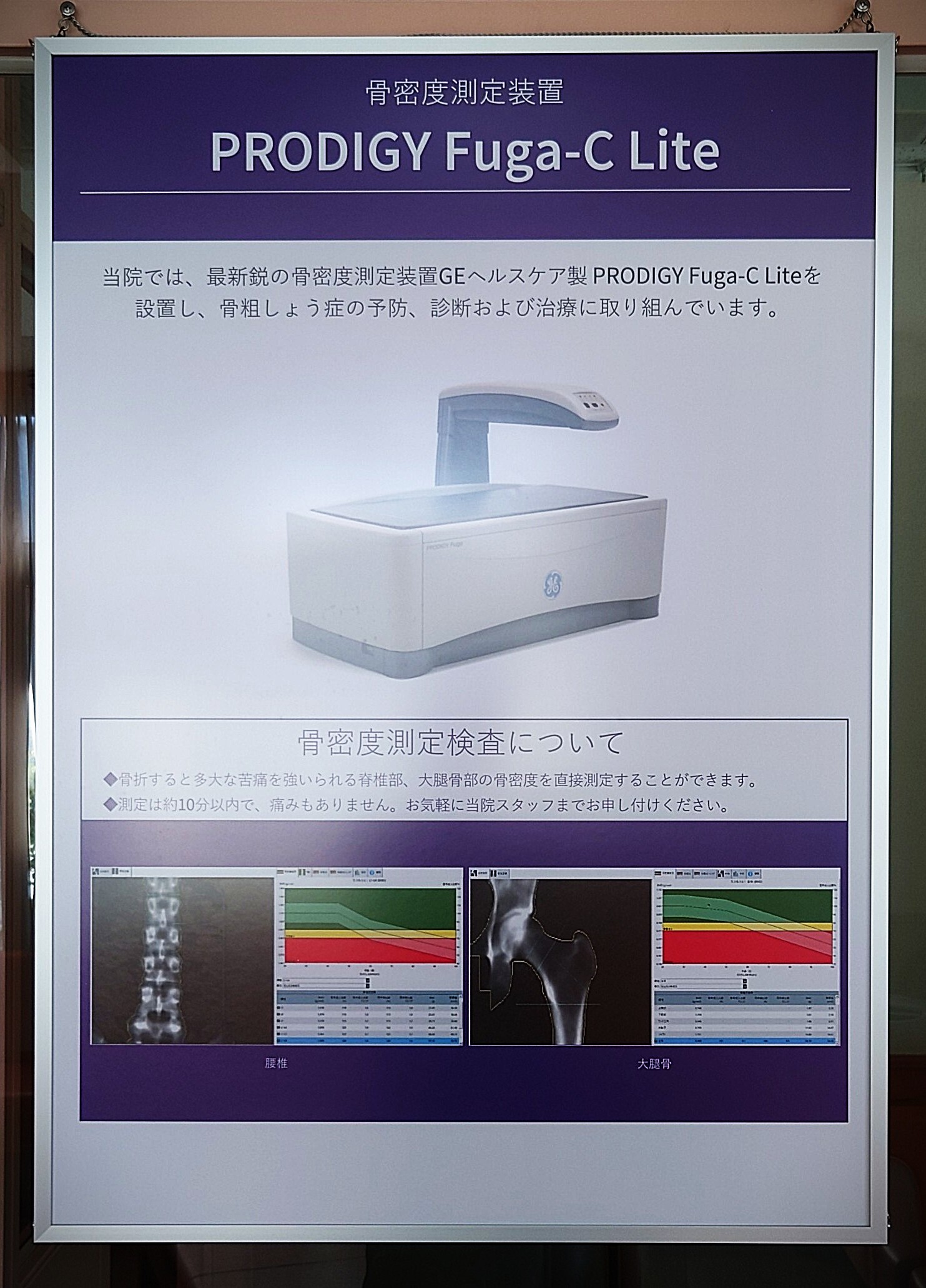超音波と内視鏡