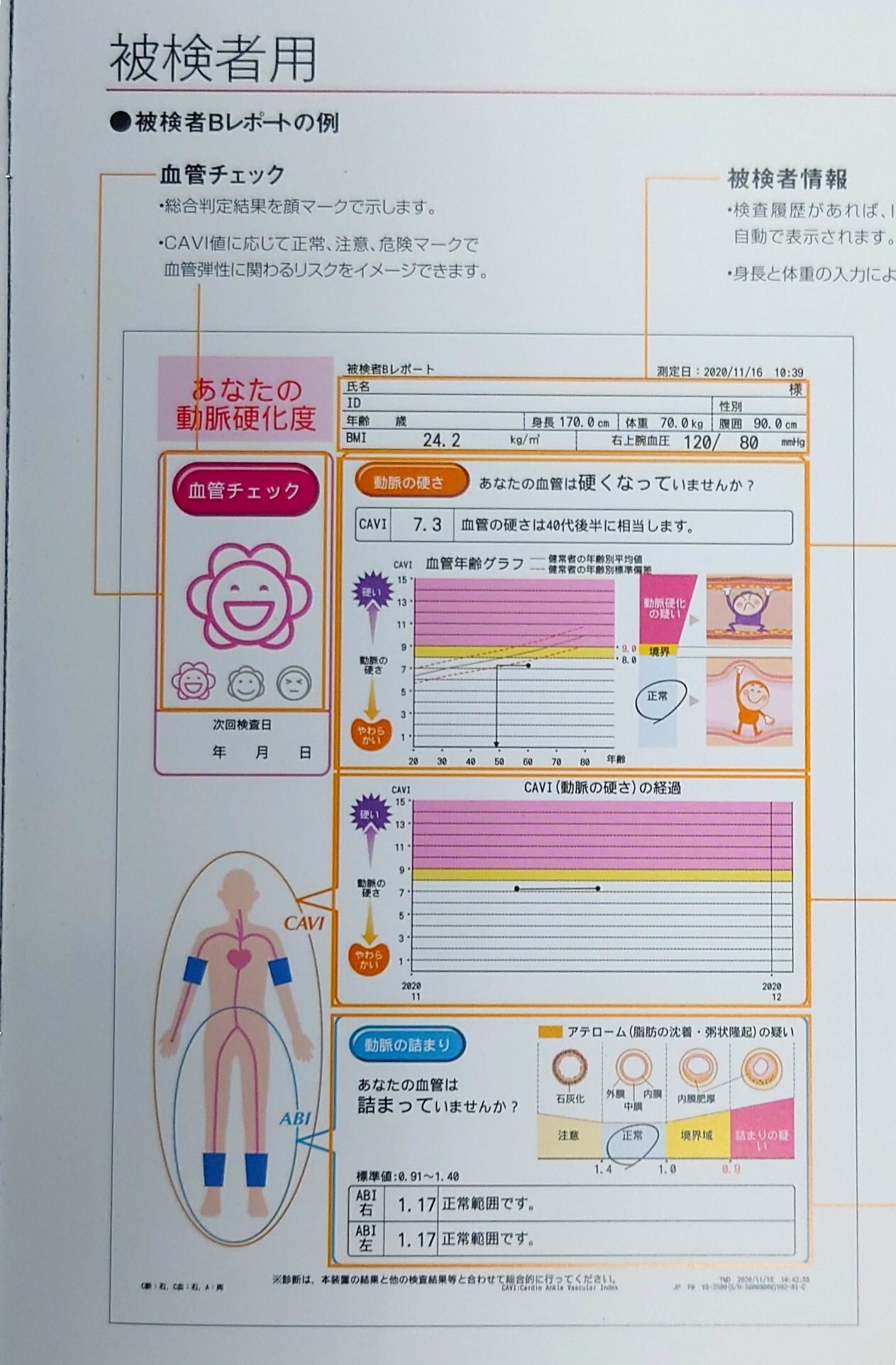 前田内科医院 心電図